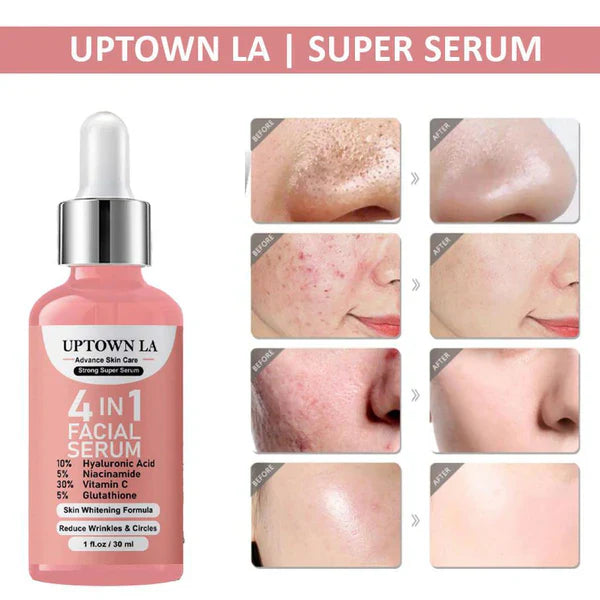 Skin Glowing Bundle Buy 1 (Uptown LA 4 In 1 Super Skin Glowing Serum) & Get 1 (Free Uptown LA 4 In 1 Whitening Cream)